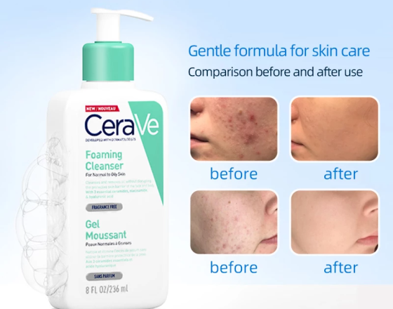 REVIEW SỮA RỬA MẶT CERAVE CHO DA DẦU MỤN ĐƯỢC CHỊ EM TÌM MUA